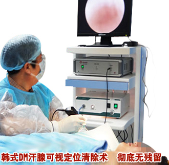 纳米微创汗腺清除术 准确定位 精细无痕